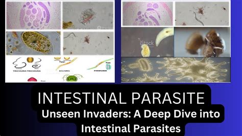  Piggy-Back Parasites: A Deep Dive into the Fascinating World of Pseudophyllidean Tapeworms